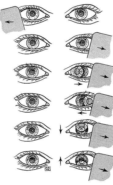 馬竇氏鏡|Motor Signs in Heterophoria and Heterotropia